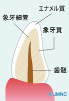 歯の構造.jpg